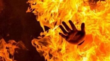 إصابة فتاة بحروق بمركز كوم أمبو باسوان| تفاصيل