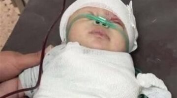 لم تتحمل فقدان جناحها.. استشهاد الرضيعة شام بعد بتر يدها إثر قصف إسرائيلي