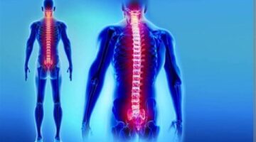 أبرزها التهاب المفاصل.. تعرف على أسباب إصابة النخاع الشوكي