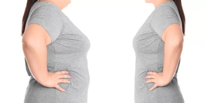 عمليات شفط الدهون تسبب الوفاة