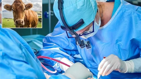 NHS تعتمد جلد الأبقار لعلاج جروح الوجه الناتجة عن سرطان الجلد NHS تعتمد جلد الأبقار لعلاج جروح الوجه الناتجة عن سرطان الجلد