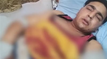 أنثى وليس ذكر.. ماذا قالت اللجنة المنتدبة في واقعة إلتهام نمر لذراع عامل بسيرك طنطا