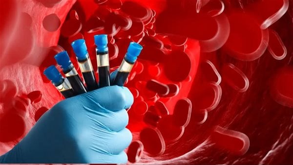 طرق تحسين مستويات الهيموجلوبين بالجسم طرق تحسين مستويات الهيموجلوبين بالجسم