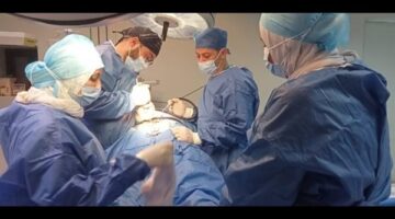 نجاح أول عملية جراحية متقدمة للعمود الفقري بمستشفى ديرب نجم المركزي بالشرقية