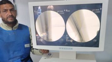 صحة المنوفية: مستشفى زاوية الناعورة يواصل التميز في جراحات العظام وخدمة المرضى