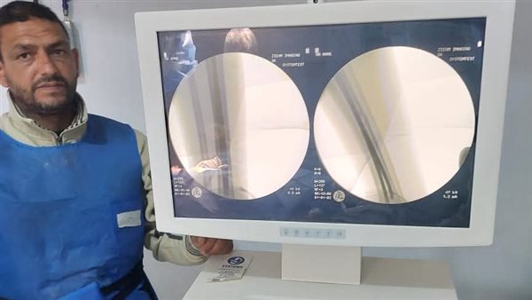 صحة المنوفية: مستشفى زاوية الناعورة يواصل التميز في جراحات العظام وخدمة المرضى صحة المنوفية: مستشفى زاوية الناعورة يواصل التميز في جراحات العظام وخدمة المرضى