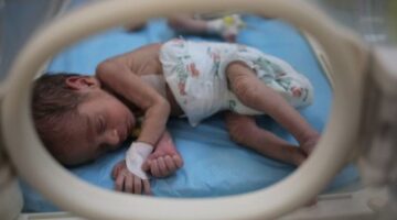 نجوا من القصف ويهددهم التجويع.. إسرائيل تخنق حديثي الولادة بغزة