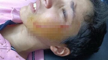 رفض مساعدته في الغش.. إحالة الطالب المتهم بالتعدي على زميله بالبدرشين للمحاكمة الجنائية