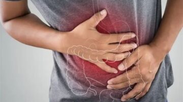 فوائد استئصال الزائدة في علاج القولون