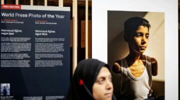 صورة طفل فلسطيني بترت ذراعاه تفوز بجائزة ورلد برس فوتو
