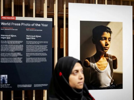 صورة طفل فلسطيني بترت ذراعاه تفوز بجائزة ورلد برس فوتو صورة طفل فلسطيني بترت ذراعاه تفوز بجائزة ورلد برس فوتو