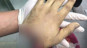ضحية البلطجة في الهرم : ضربوني وسرقوا التليفون | تفاصيل مأساوية
