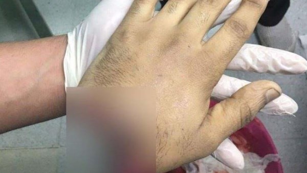 ضحية البلطجة في الهرم : ضربوني وسرقوا التليفون | تفاصيل مأساوية ضحية البلطجة في الهرم : ضربوني وسرقوا التليفون | تفاصيل مأساوية