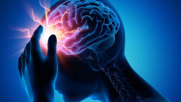 دراسة توضح علاقة الصداع النصفي بزيادة خطر السكتة الدماغية المبكرة دراسة توضح علاقة الصداع النصفي بزيادة خطر السكتة الدماغية المبكرة