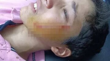 قرار عاجل بشأن محاكمة طالب شوه وجه زميله بـ27 غرزة بالبدرشين