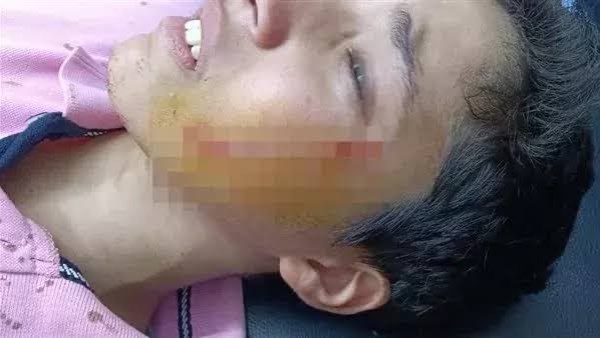 قرار عاجل بشأن محاكمة طالب شوه وجه زميله بـ27 غرزة بالبدرشين قرار عاجل بشأن محاكمة طالب شوه وجه زميله بـ27 غرزة بالبدرشين
