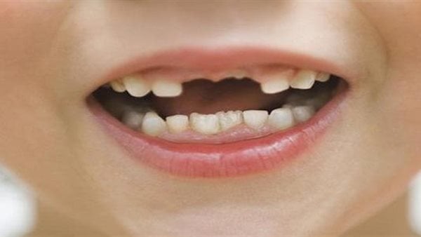 أطعمة شائعة تضر بصحة الأسنان.. تعرف عليها أطعمة شائعة تضر بصحة الأسنان.. تعرف عليها