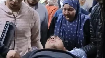 مصادر طبية: تحسن في حالة عامل السيرك بعد وعكة صحية مفاجئة.. القصة الكاملة