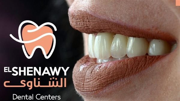 ما هي أسعار تبييض الأسنان في مصر 2025؟ ما هي أسعار تبييض الأسنان في مصر 2025؟