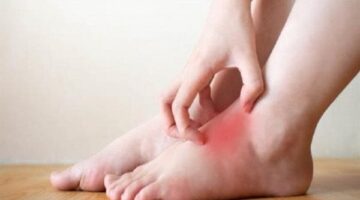 هل يشير الشعور بالحرقان في قدميك إلى مرض السكري أو نقص الفيتامينات؟