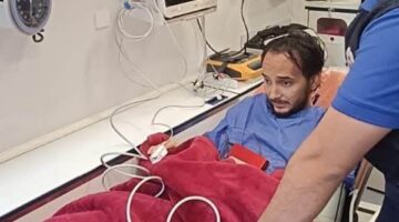 60 يوما معاناة.. حكاية طبيب عانى من مرض نادر ورئيس استجاب لاستغاثته