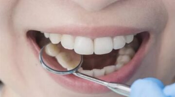 5 أشياء ابتعد عنها للحفاظ على أسنانك لامعة وقوية