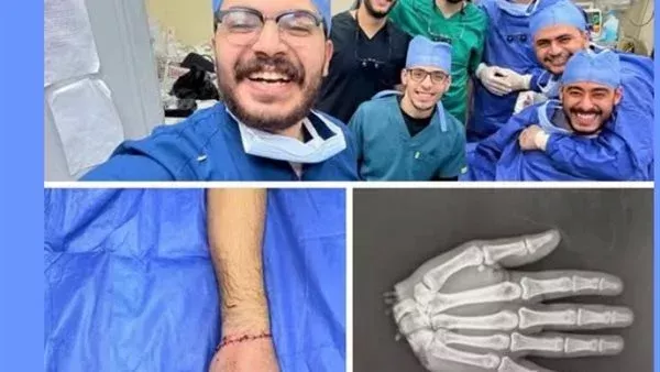 كنا 10 أطباء واستغرقنا 12 ساعة.. أول تعليق من دكتور بطب الأزهر نجح في إعادة يد شاب بعد بترها بالكامل كنا 10 أطباء واستغرقنا 12 ساعة.. أول تعليق من دكتور بطب الأزهر نجح في إعادة يد شاب بعد بترها بالكامل