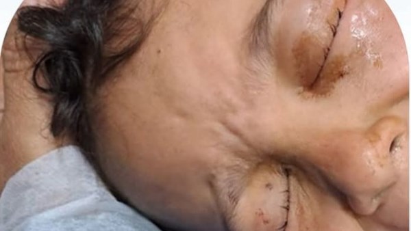 معجزة طبية في دسوق .. فريق أطباء ينقذ بصر 3 أطفال أشقاء من العمى معجزة طبية في دسوق .. فريق أطباء ينقذ بصر 3 أطفال أشقاء من العمى