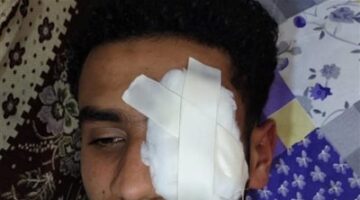 ضبط المتهمين بالتسبب فى فقد عين شاب بالغربية