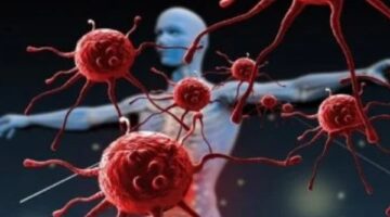 نوع خضار غير متوقع يمنع السرطان والأمراض المزمنة