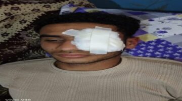 شاب يفقد بصره على يد آخر بسبب مشادة لفظية في عزبة الفار بطنطا