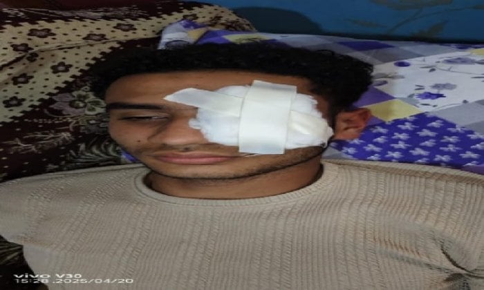 شاب يفقد بصره على يد آخر بسبب مشادة لفظية في عزبة الفار بطنطا شاب يفقد بصره على يد آخر بسبب مشادة لفظية في عزبة الفار بطنطا