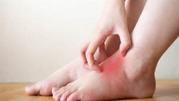 أبرزها تورم القدمين.. حالات تتطلب الحصول على رعاية صحية أبرزها تورم القدمين.. حالات تتطلب الحصول على رعاية صحية