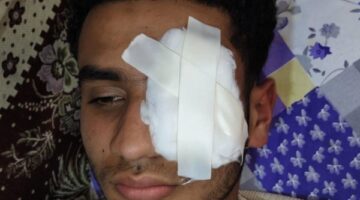 لرفضه لعن وطعن السيدات في شرفهن.. الكوارشي يعتدي على شاب ويفقأ عينه بطنطا |القصة الكاملة