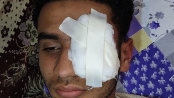 لرفضه لعن وطعن السيدات في شرفهن.. الكوارشي يعتدي على شاب ويفقأ عينه بطنطا |القصة الكاملة لرفضه لعن وطعن السيدات في شرفهن.. الكوارشي يعتدي على شاب ويفقأ عينه بطنطا |القصة الكاملة