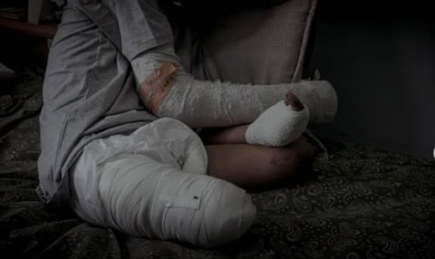 إسرائيل بترت ساقيه.. “الغلبان” فتى الجمباز يحلم بأطراف صناعية إسرائيل بترت ساقيه.. “الغلبان” فتى الجمباز يحلم بأطراف صناعية