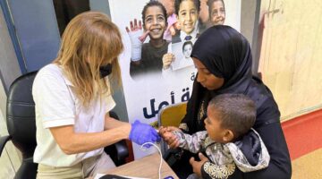 الرعاية الصحية: نجاح قافلة جراحات تجميل الأطفال «روتابلاست» بمستشفياتها في الأقصر
