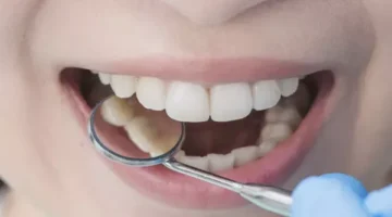 أطباء ينصحون بهذه الأطعمة لتعزيز صحة الأسنان