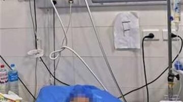 انقاذ حياة فتاة من الموت بإختناق القلب في مستشفى شرق المدينة بالإسكندرية