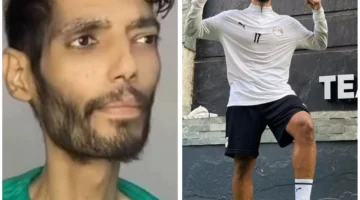 حلم كروي انتهى مبكرًا بسرطان المستقيم.. ما هو مرض إبراهيم شيكا لاعب الزمالك؟