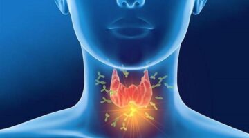دراسة تثبت امكانيه علاج انسداد شرايين الرقبة دون الحاجة لعمليات جراحية