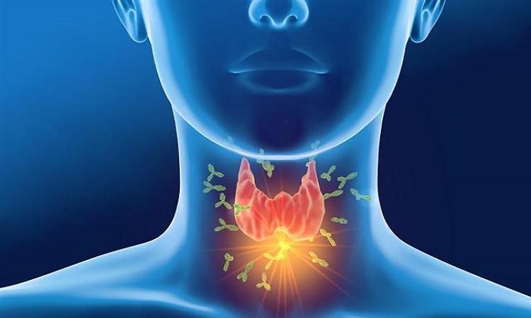 دراسة تثبت امكانيه علاج انسداد شرايين الرقبة دون الحاجة لعمليات جراحية دراسة تثبت امكانيه علاج انسداد شرايين الرقبة دون الحاجة لعمليات جراحية