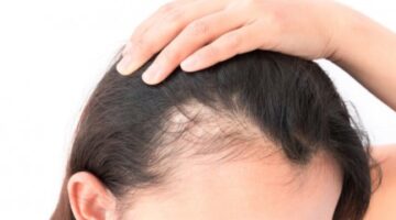 طرق طبيعية لتكثيف الشعر: حل فعّال لمشكلة الشعر الخفيف