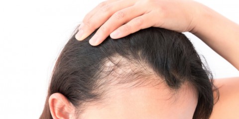 طرق طبيعية لتكثيف الشعر: حل فعّال لمشكلة الشعر الخفيف طرق طبيعية لتكثيف الشعر: حل فعّال لمشكلة الشعر الخفيف