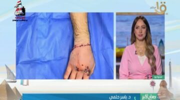 مستشفى جامعي يحقق إنجازًا طبيًا نادرًا بإعادة توصيل يد مبتورة