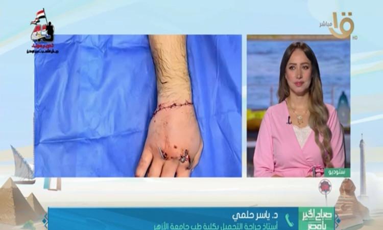 مستشفى جامعي يحقق إنجازًا طبيًا نادرًا بإعادة توصيل يد مبتورة مستشفى جامعي يحقق إنجازًا طبيًا نادرًا بإعادة توصيل يد مبتورة