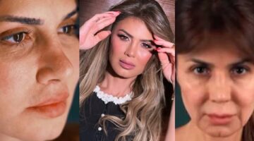 نجلاء بدر تثير الجدل بعد خضوعها لإجراء تجميلي.. وتعلق: رجعت زي زمان