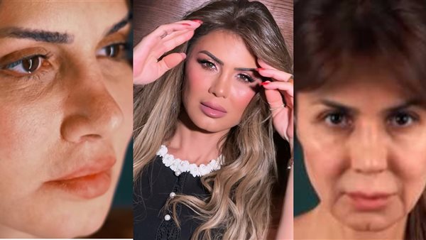 نجلاء بدر تثير الجدل بعد خضوعها لإجراء تجميلي.. وتعلق: رجعت زي زمان نجلاء بدر تثير الجدل بعد خضوعها لإجراء تجميلي.. وتعلق: رجعت زي زمان
