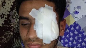 نهاية صادمة لشاب طنطا.. «كلمة دفاع عن الشرف.. كلفته عينه»