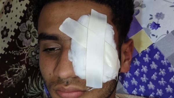 نهاية صادمة لشاب طنطا.. «كلمة دفاع عن الشرف.. كلفته عينه» نهاية صادمة لشاب طنطا.. «كلمة دفاع عن الشرف.. كلفته عينه»